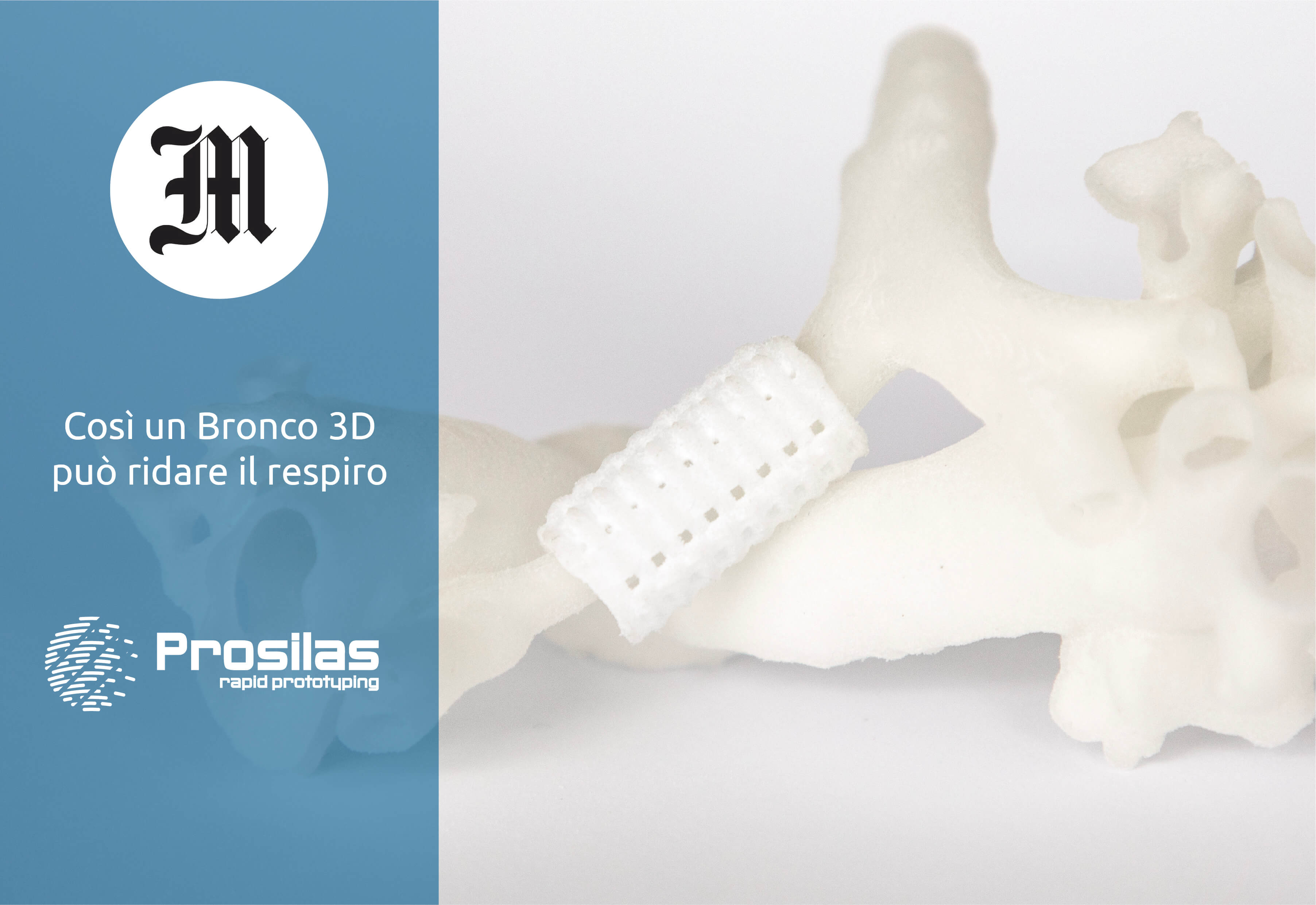 Prosilas – Così un Bronco 3D  può ridare il respiro – il Messaggero