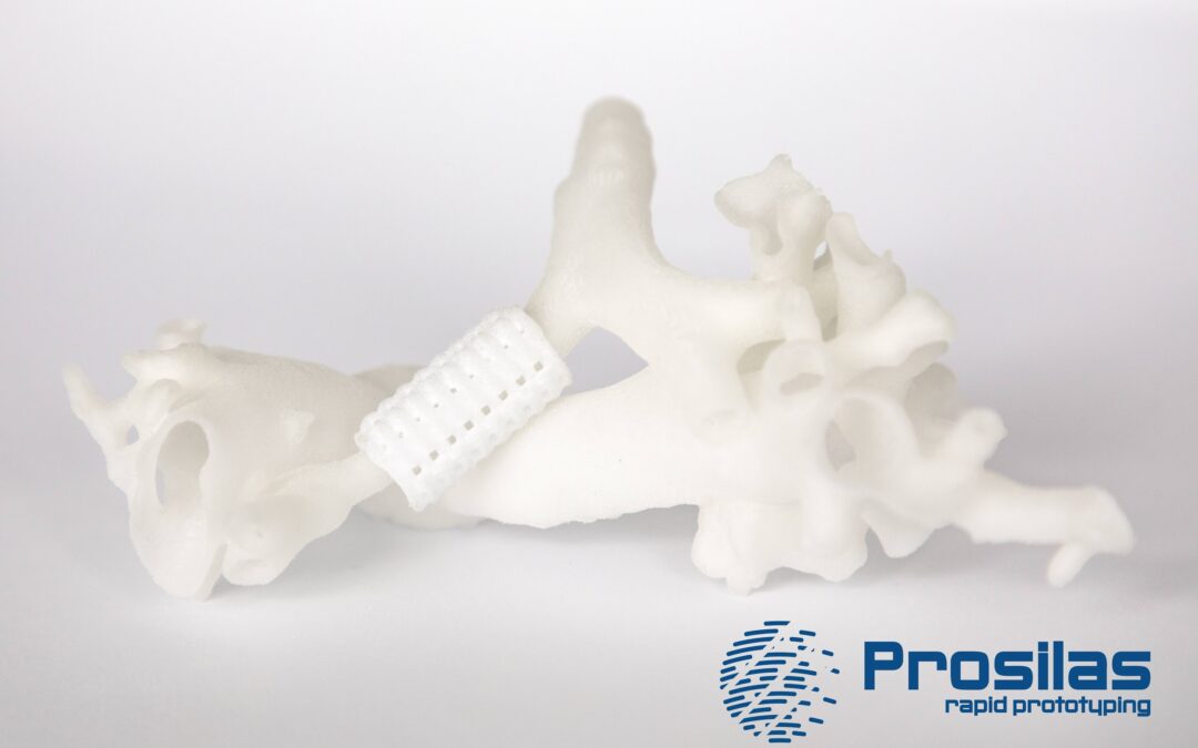 Materiale biocompatibile per la stampa 3D: Policaprolattone PCL